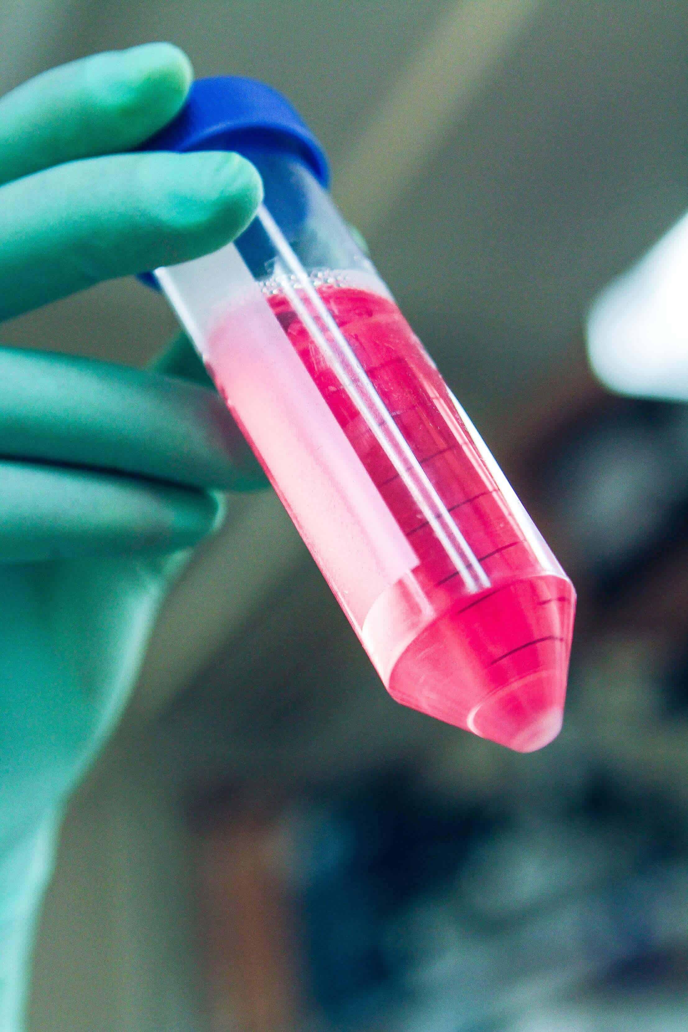 Lab Test Tube