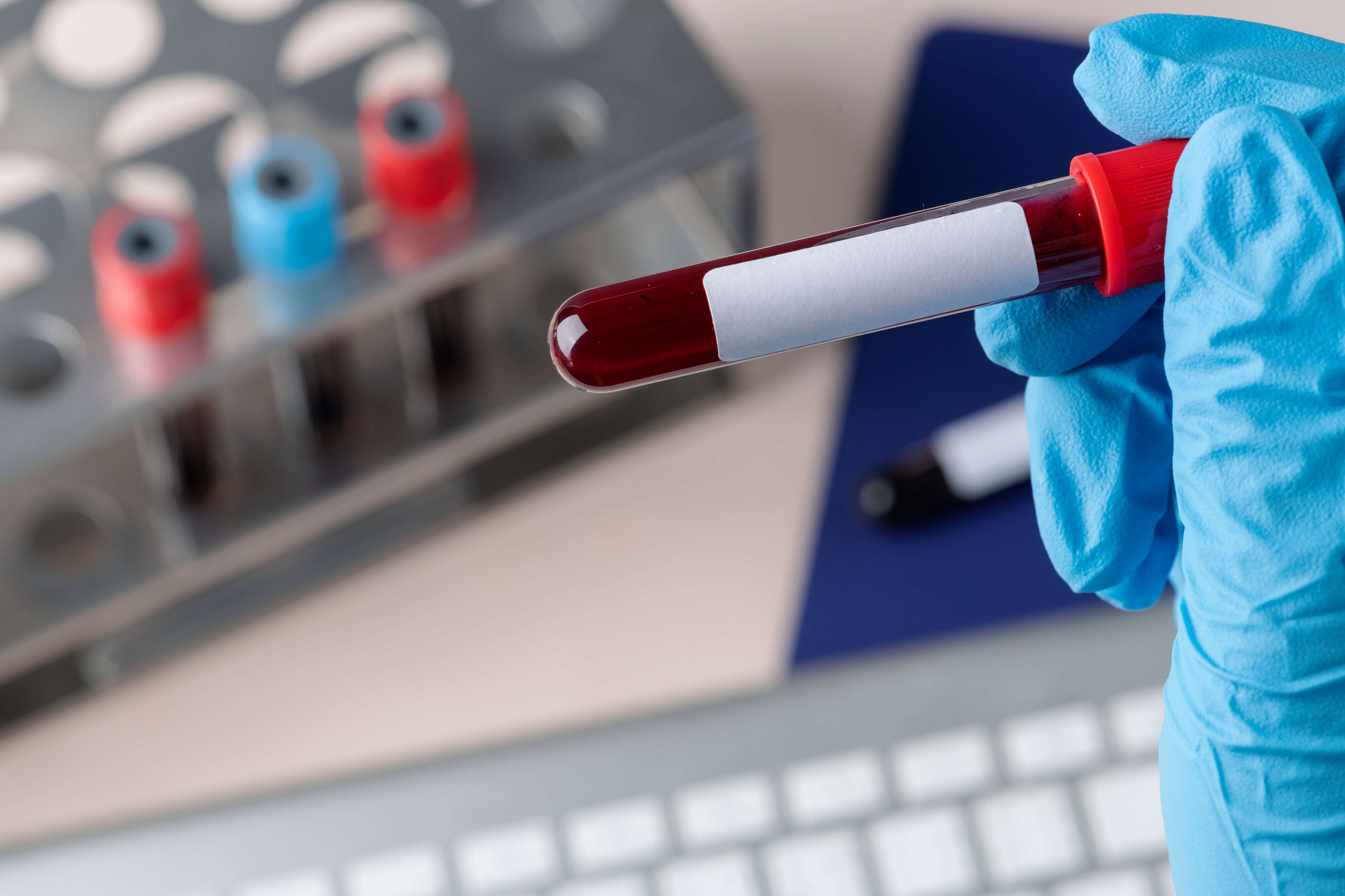 Blood test tube